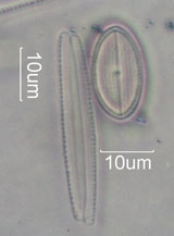 Diatom